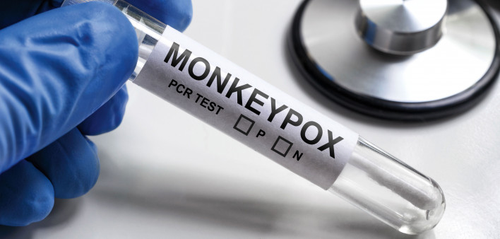 MonkeyPOX on test tube