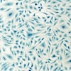 HeLa cervical cancer cells, stained with Coomassie blue, under microscope.