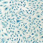 HeLa cervical cancer cells, stained with Coomassie blue, under microscope.