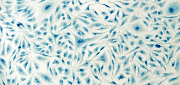 HeLa cervical cancer cells, stained with Coomassie blue, under microscope.