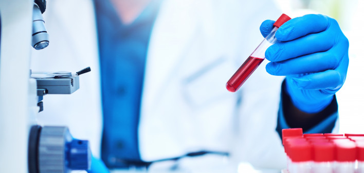Closeup shot of a scientist analyzing samples in a laboratory