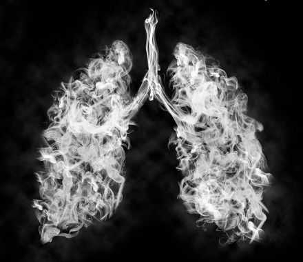 Illustration of a toxic smoke in Lung