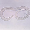 This photomicrograph reveals ultrastructural details in a parasitic hookworm larva.