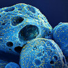 Colorized scanning electron micrograph of a cell (blue) infected with the Omicron strain of SARS-CoV-2 virus particles (yellow)