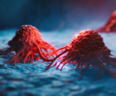 cancer cells