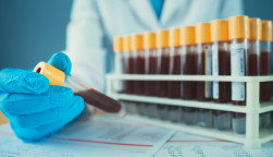 Blood vials in laboratory scientist