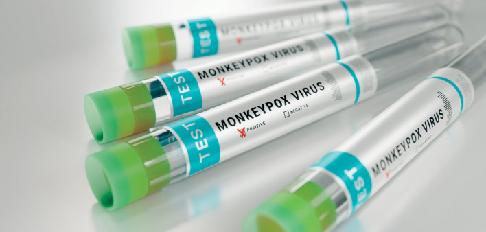 tubes monkeypox virus