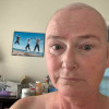 Robin McGee cancer survivor