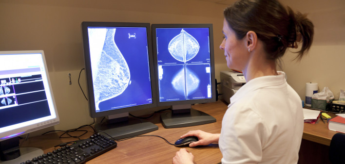 Photo about Radiology technician examens mammography test. Image of technician, horizontal, radiology