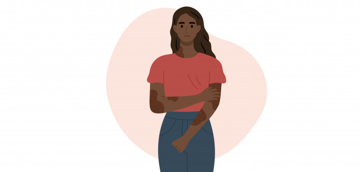illustration sad girl with a rash