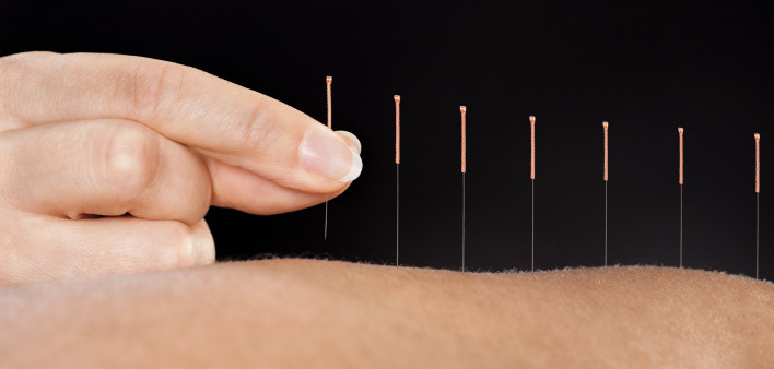 fingers with acupuncture needles in arm
