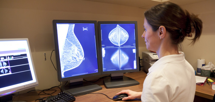 Photo about Radiology technician examens mammography test. Image of technician, horizontal, radiology