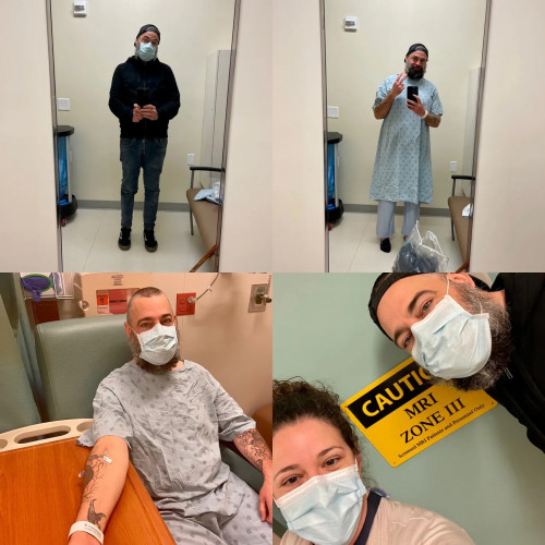 adam hayden glioblastom brain cancer mri