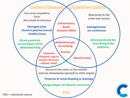 colon cancer foundation blog posted 27 nov 2023 titled Crohn’s Disease, Ulcerative Colitis and Colorectal Cancer: How Different Are They?