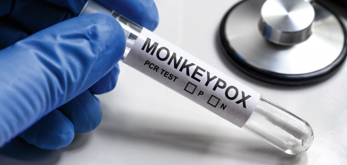 MonkeyPOX on test tube