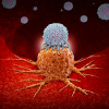 CAR-T therapy in which modified T cells (illustrated in white) attack cancer