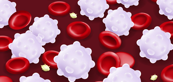 Leukemia. Red blood cells, White blood cells and platelets.