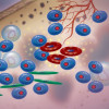 Multiple myeloma cells