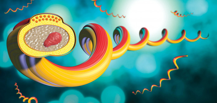 illustration of Syphilis