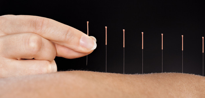 fingers with acupuncture needles in arm