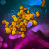Novel coronavirus SARS-CoV-2
