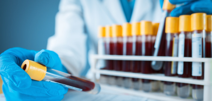 Laboratory result with blood tubes