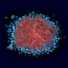 Colorized transmission electron micrograph of numerous HIV-1 virus particles (blue) replicating from a segment of a chronically infected H9 T cell (red)