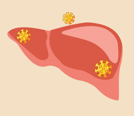 illlustration liver and hepetisis virus