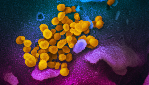 Novel coronavirus SARS-CoV-2