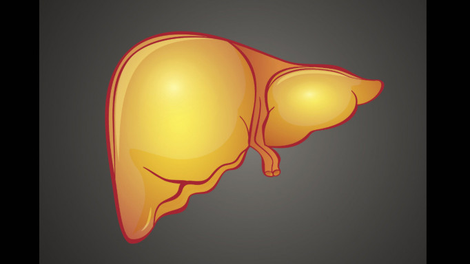 fatty liver