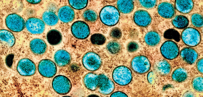 Monkeypox virus