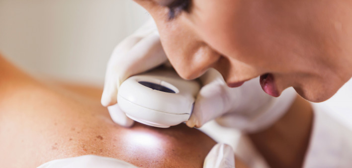 Dermatologist looking at skin with a magnifier skin cancer check