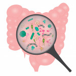 Bacterial overgrowth in small intestine.