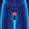 illustration prostate