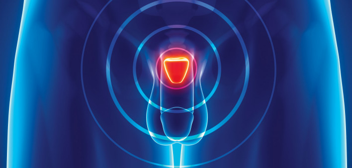 illustration prostate