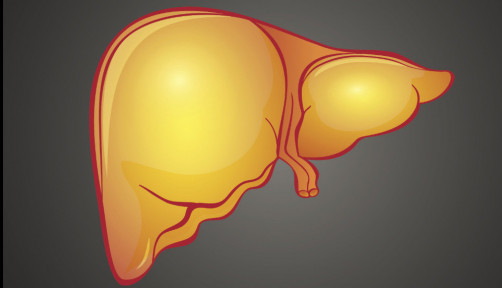 fatty liver