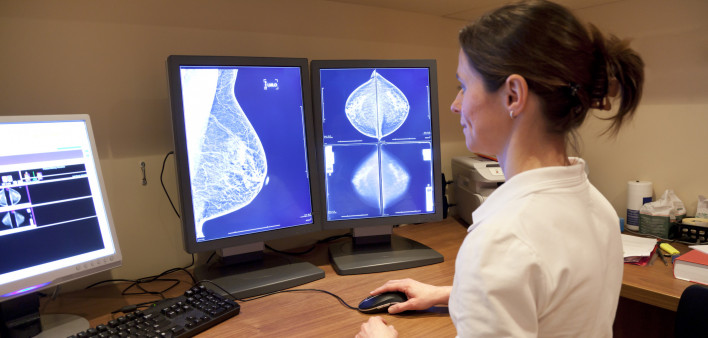 Photo about Radiology technician examens mammography test. Image of technician, horizontal, radiology