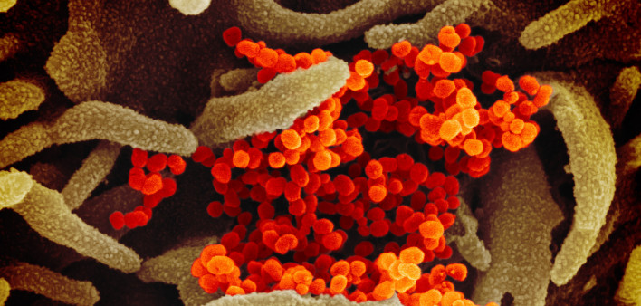Novel coronavirus SARS-CoV-2