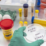 Scientific sampling of eggs in poor condition, analysis of avian influenza in humans, conceptual image