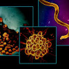 Electron micrograph imagery of bacteria that cause three sexually transmitted infections: chlamydia (left), gonorrhea (center), and syphilis (right).