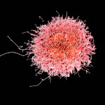 Colorized scanning electron micrograph of a natural killer cell from a human donor