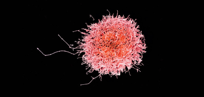Colorized scanning electron micrograph of a natural killer cell from a human donor