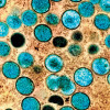 Monkeypox virus