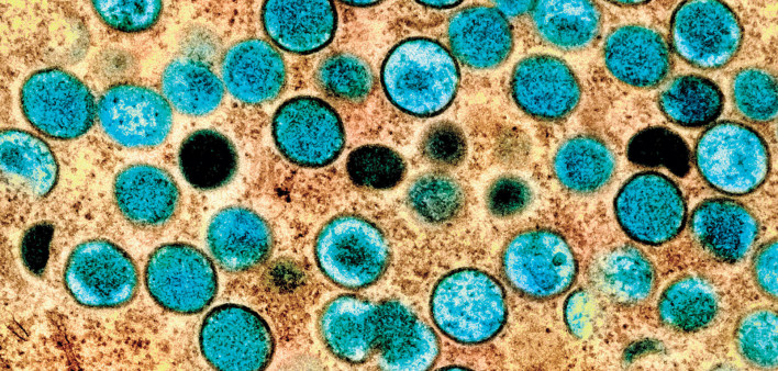 Monkeypox virus