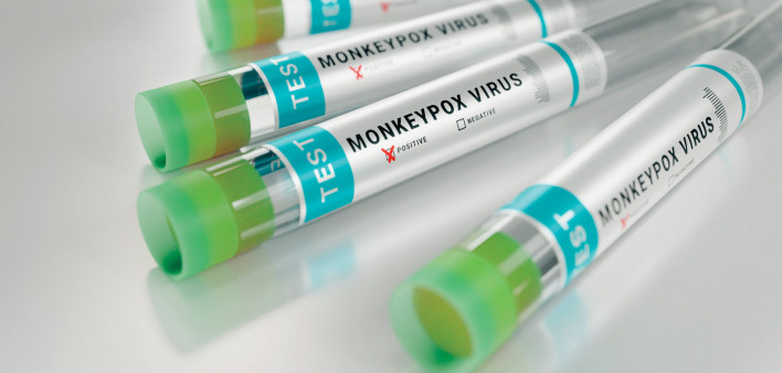 tubes monkeypox virus