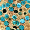 Monkeypox virus