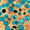 Monkeypox virus