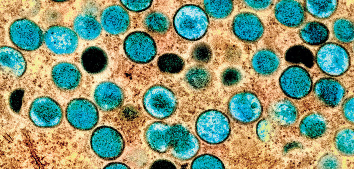 Monkeypox virus