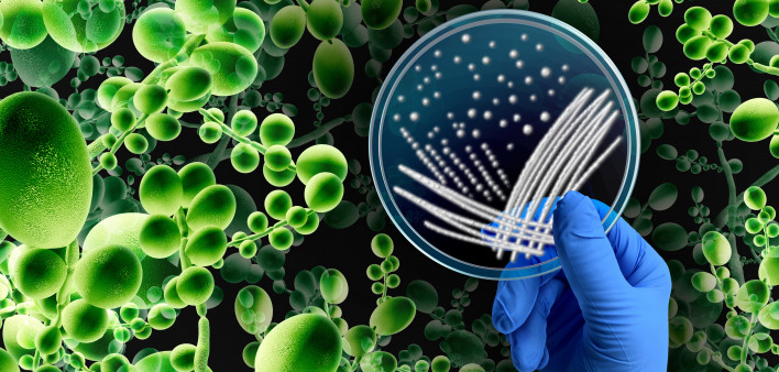 Superbug Fungus microbiology as Deadly Fungal Infection concept as a microbe threat and mucormycosis as Candida auris fungi spreading as a Mycology with a scientist holding a petri dish.
