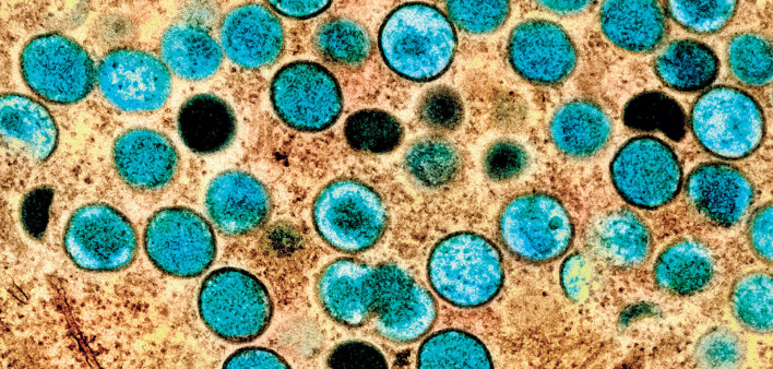 Monkeypox virus
